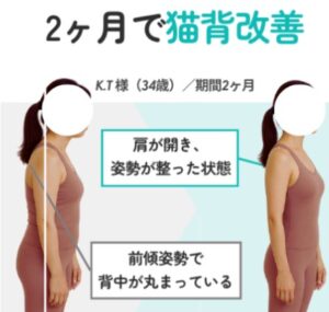 ピラティス効果猫背改善写真