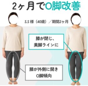 ピラティス効果O脚改善写真